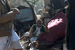 گزارش تصویری,ویرانی,خون,تجاوز,سعودی,دانلود عکس,تصاویر,یمن,مجروحان,بیمارستان,جنگ,بمباران,مردم,انصارالله,الحوثی